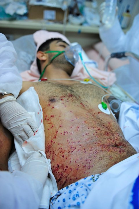 Bahrain, 2011: Yet another victim of repression by Bahraini and Saudi security forces.  Mass protests against the Bahraini monarchy have been murderously attacked by the U.S.-backed regime.